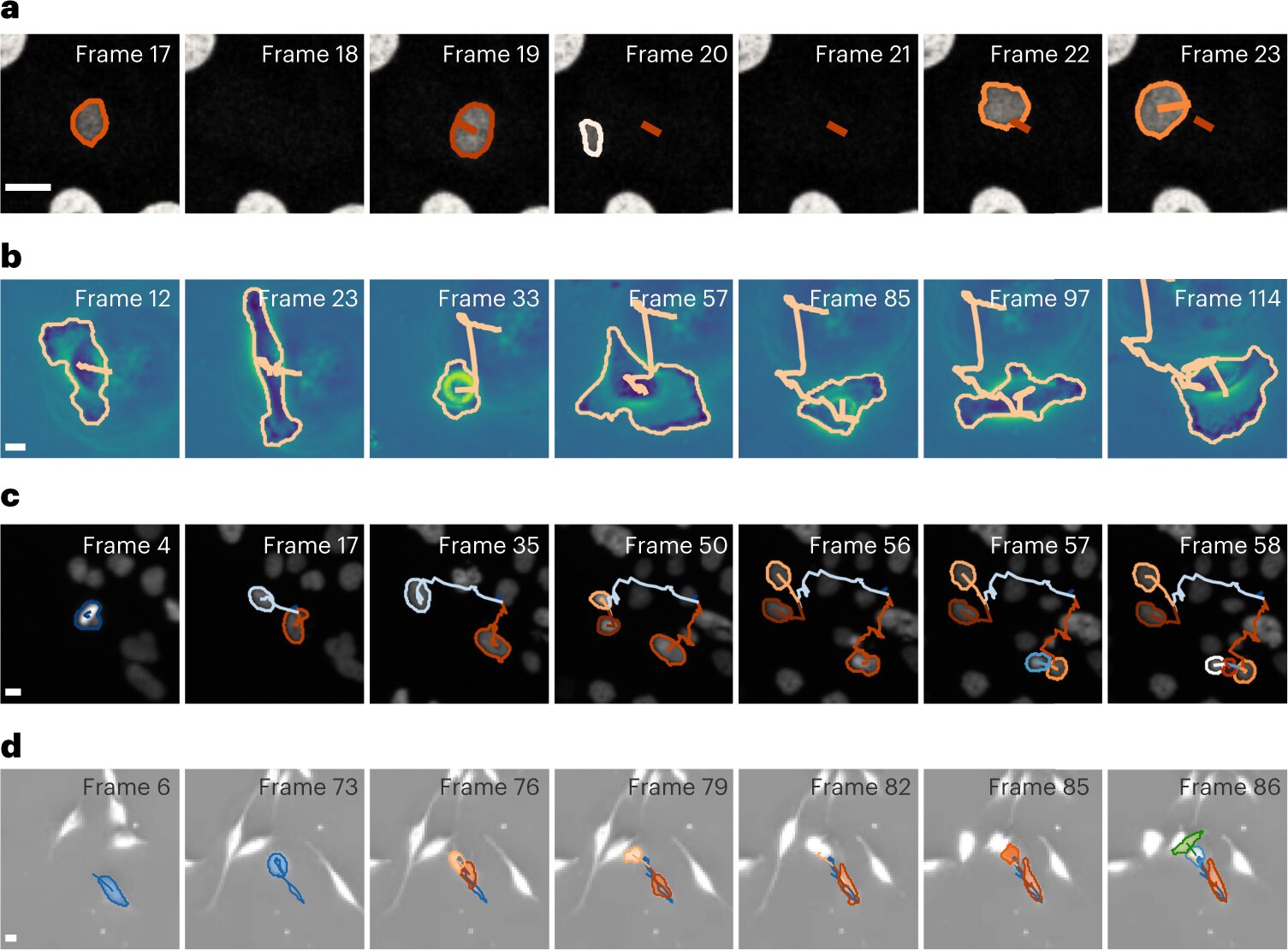 AI analiza el movimiento celular bajo el microscopio