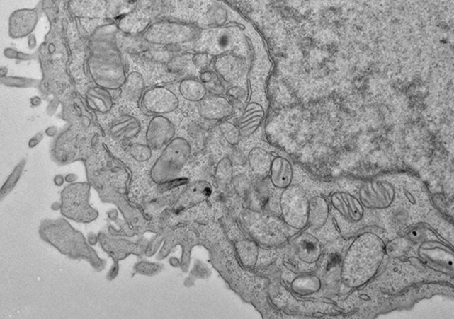 Se ha demostrado que las células madre sanguíneas son susceptibles a la ferroptosis, un tipo de muerte celular