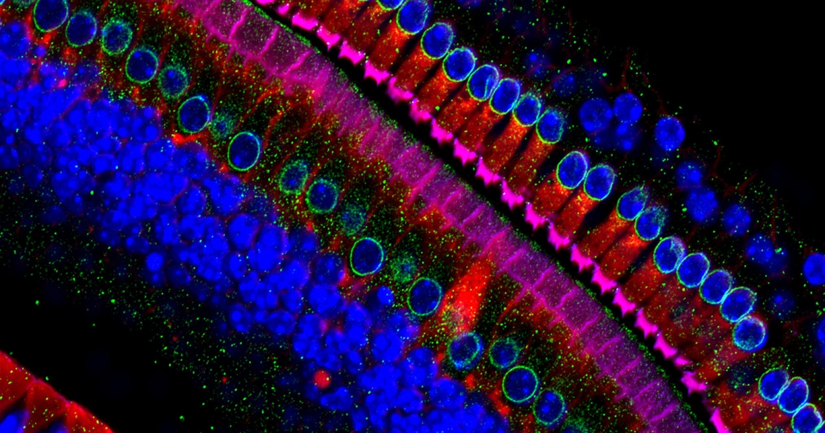 Un nuevo estudio descubre cómo revertir la pérdida auditiva