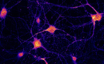 El eslabón perdido explica la entrega de ARNm en las células cerebrales