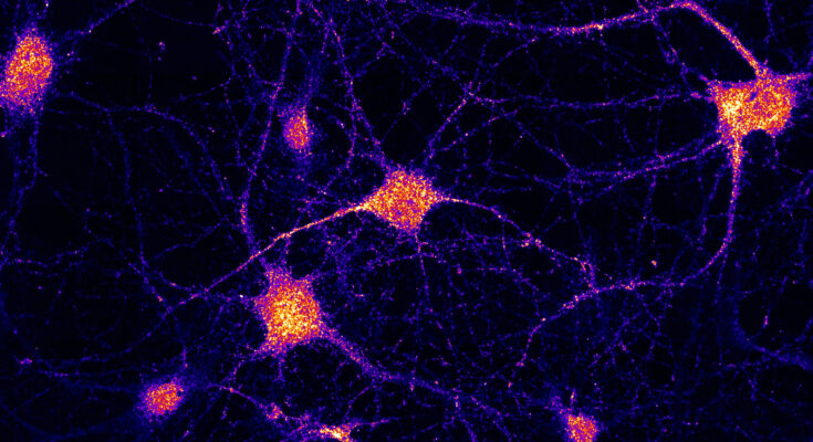 El eslabón perdido explica la entrega de ARNm en las células cerebrales