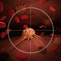 NXC-201 demuestra la viabilidad de la terapia con células T con CAR dirigida por BCMA en la amiloidosis AL en recaída/refractaria