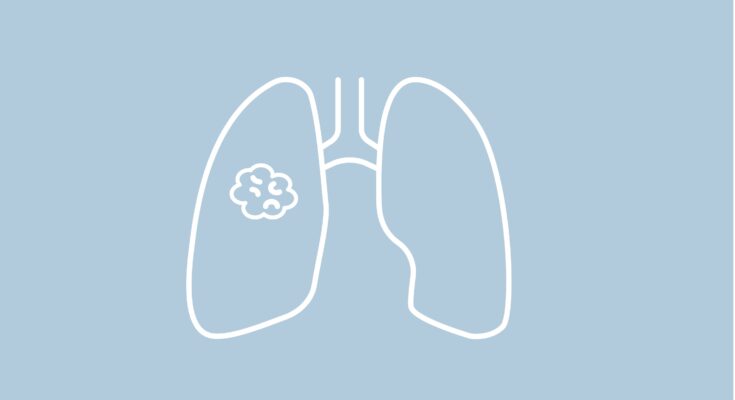 Repotrectinib demuestra respuestas intracraneales tempranas en NSCLC ROS1+ seleccionado