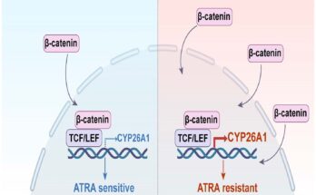 Investigación: la proteína similar a CAR dirige la respuesta del ácido retinoico en el cáncer colorrectal