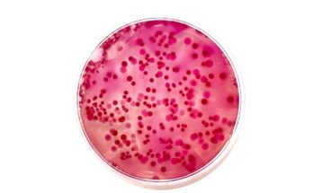 Los científicos han descubierto decenas de especies bacterianas previamente desconocidas en pacientes hospitalizados.