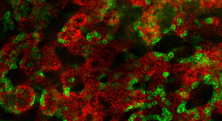 En un gran avance, científicos de la Universidad Bar-Ilan crean testículos artificiales cultivados en laboratorio
