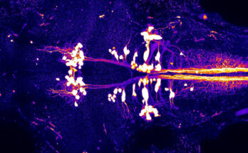The head and the beginning portion of a young zebrafish's body, seen from the top (with the eyes to the left), featuring neurons (appearing as white dots) that transmit signals to the spinal cord, orchestrating the movement of the body. (Credit: NIH Image Gallery/Richard Roberts)