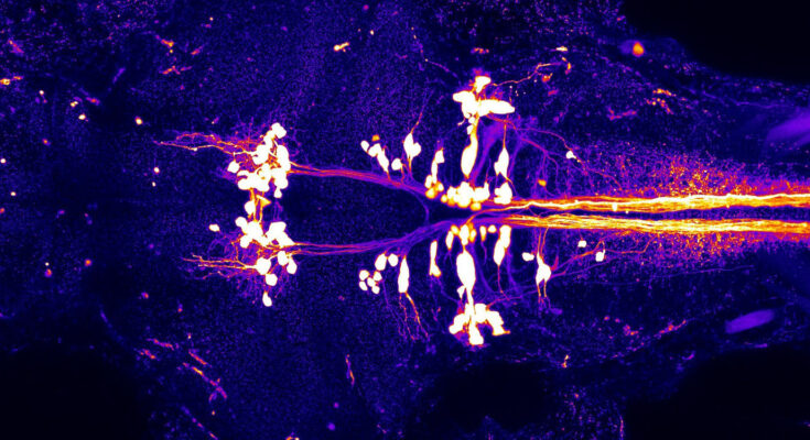 The head and the beginning portion of a young zebrafish's body, seen from the top (with the eyes to the left), featuring neurons (appearing as white dots) that transmit signals to the spinal cord, orchestrating the movement of the body. (Credit: NIH Image Gallery/Richard Roberts)
