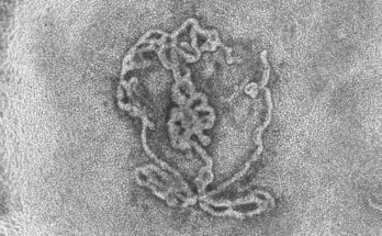 Black and white microscope image of an artificial testicle which looks like a bundle of noodles