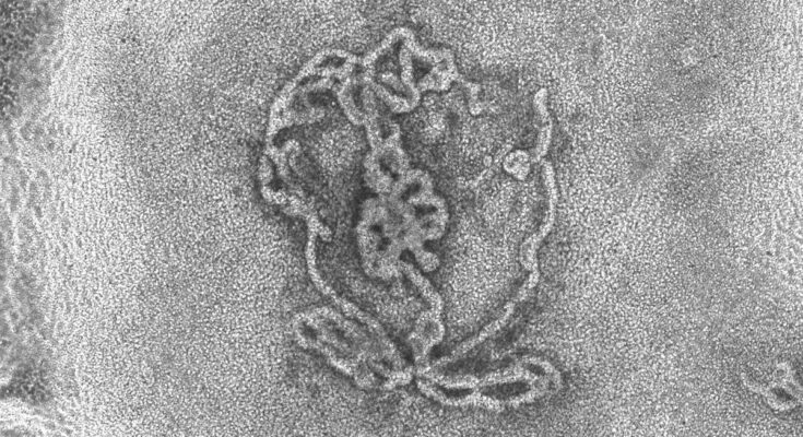Black and white microscope image of an artificial testicle which looks like a bundle of noodles