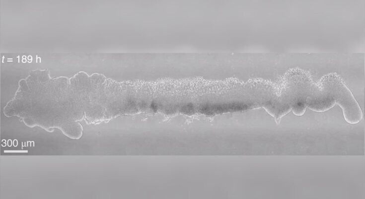 Un minimodelo del cerebro y la médula espinal de un embrión humano cultivado en el laboratorio.