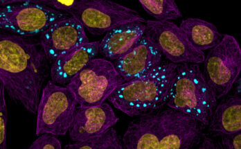 Un atlas impulsado por IA revela cómo se comportan las proteínas dentro de las células