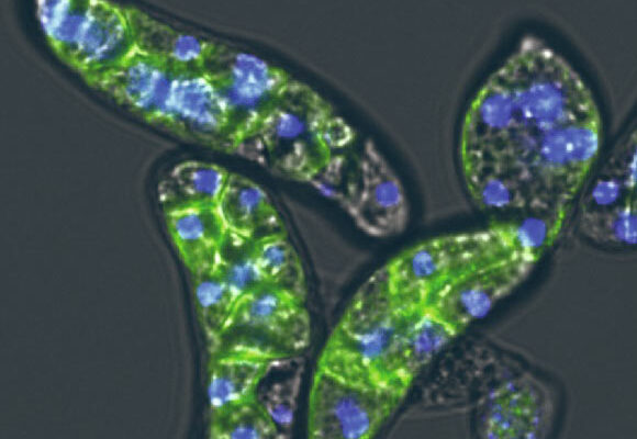 Amoebidium appalachense is a unique model to understand the hybrid origins of eukaryotic DNA. Image credit: Alex de Mendoza.