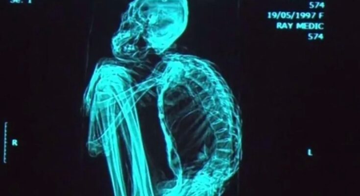 Los expertos en ADN confirman que al menos un tipo de momia de Nazca es, supuestamente, parte del árbol genético de la vida.
