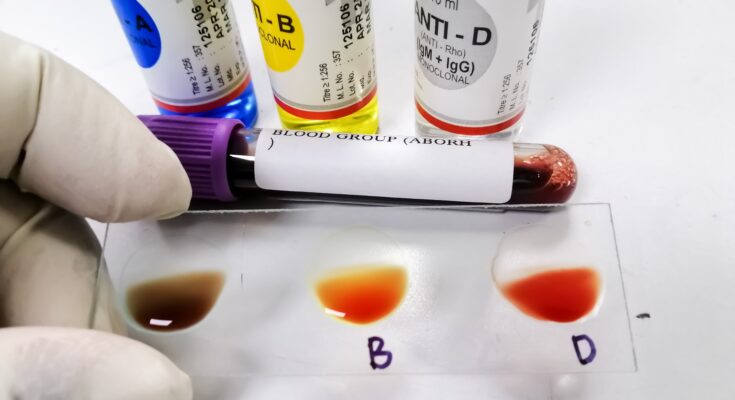 Neither A nor AB - Scientists Discover the MAL Blood Group, Solving a Medical Mystery of More Than 50 Years