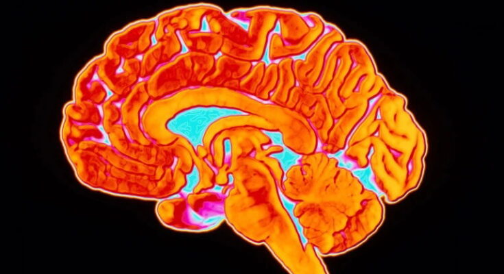 Brain