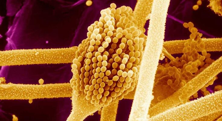 Los resultados de la pluma han descubierto que el hongo ataca a las células cancerosas de la tumba del rey tut