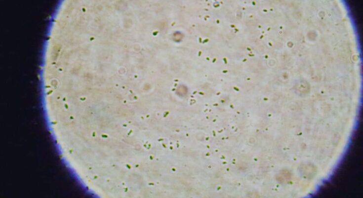 Nasa’s Clean Rooms May Have Accidentally Sent This “zombie” Bacteria To Mars