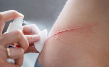 Spray Antiseptic Cut Scratch Wound